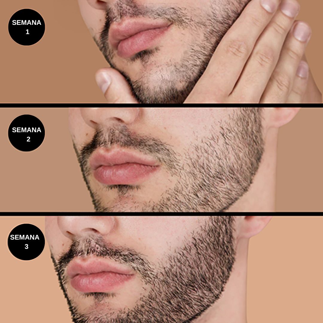 Aceite Activador de Barba Moxxira™