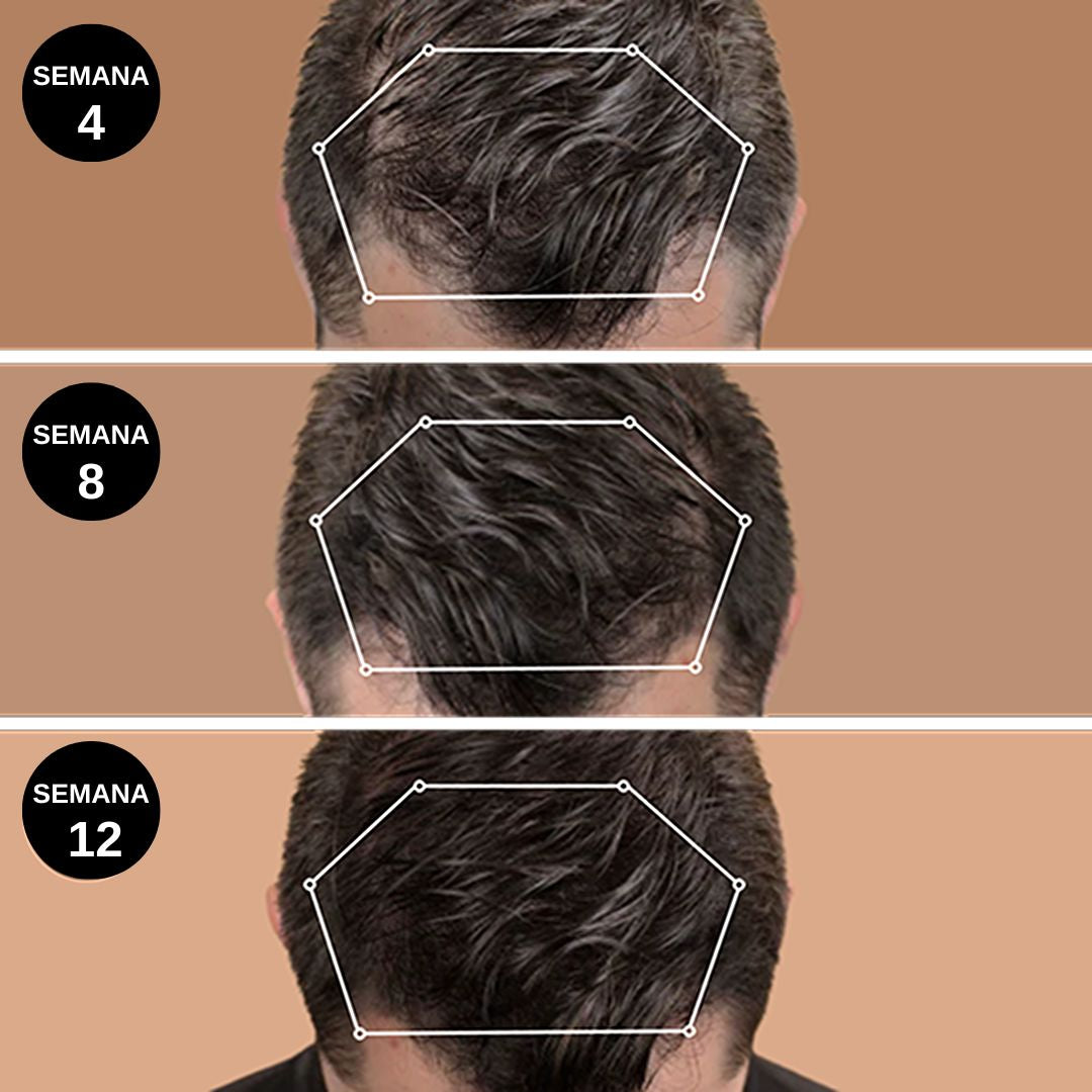 Champú Crecimiento Activo Moxxira ™