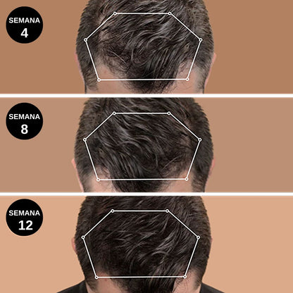 Champú Crecimiento Activo Moxxira ™